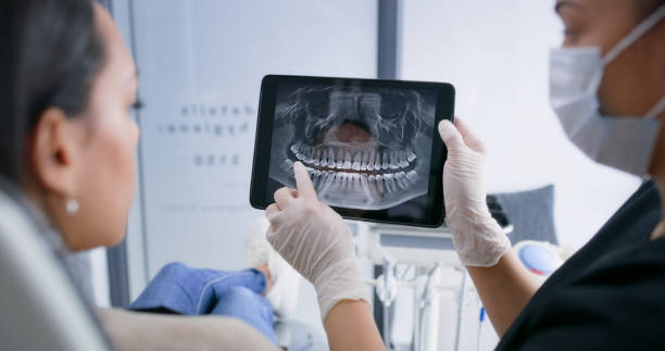 Licensed Wisdom Tooth Removal service in Paw Paw Lake, MI - Smile Center Dentistry